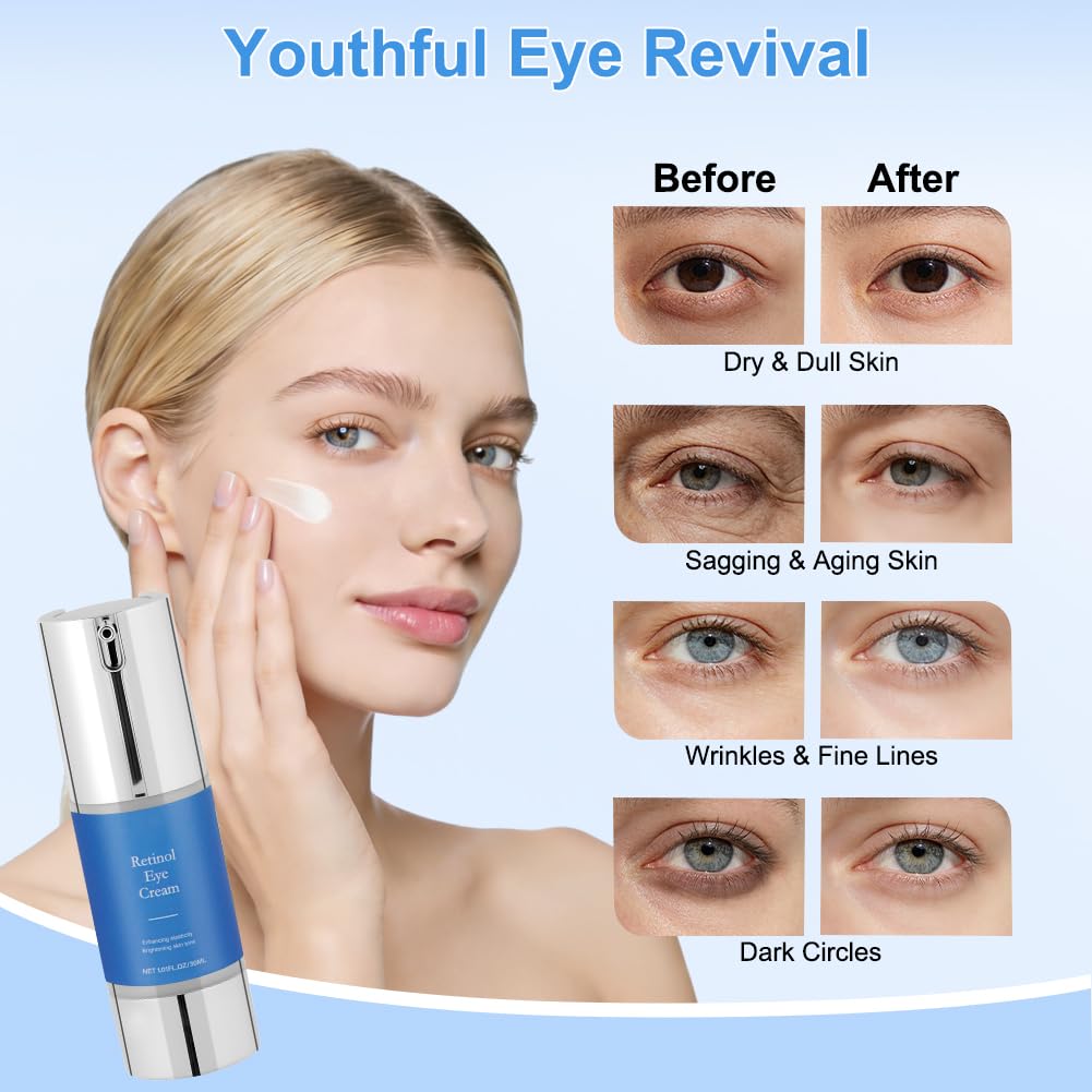 Aomig Retinol Krem pod oczy, 30 ml Krem przeciwzmarszczkowy i starzejący się do oczu z Bakuchiolem, Redukuje zmarszczki i drobne zmarszczki, zmniejsza obrzęki i cienie pod oczami, nawilżający