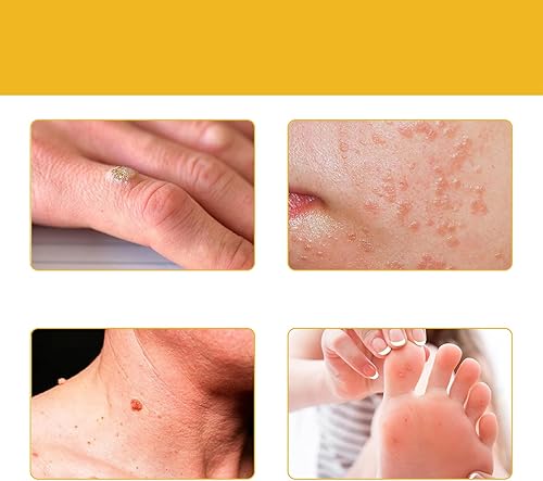 Miniatura 6 de Beneture Bee Venom Crema de eliminación de piel, crema reparadora de máxima fuerza, crema profesional de eliminación y reparación de veneno de abeja