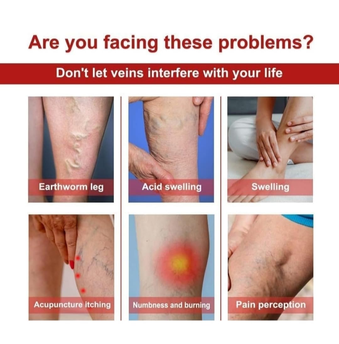 SEINON'S Varicose Veins Patches Dredge Vein Smoothing Varicose Veins Reduce Swelling Relieve Pain Instant Relief From Muscular Pain Improve Blood Circulation Skin Friendly 1