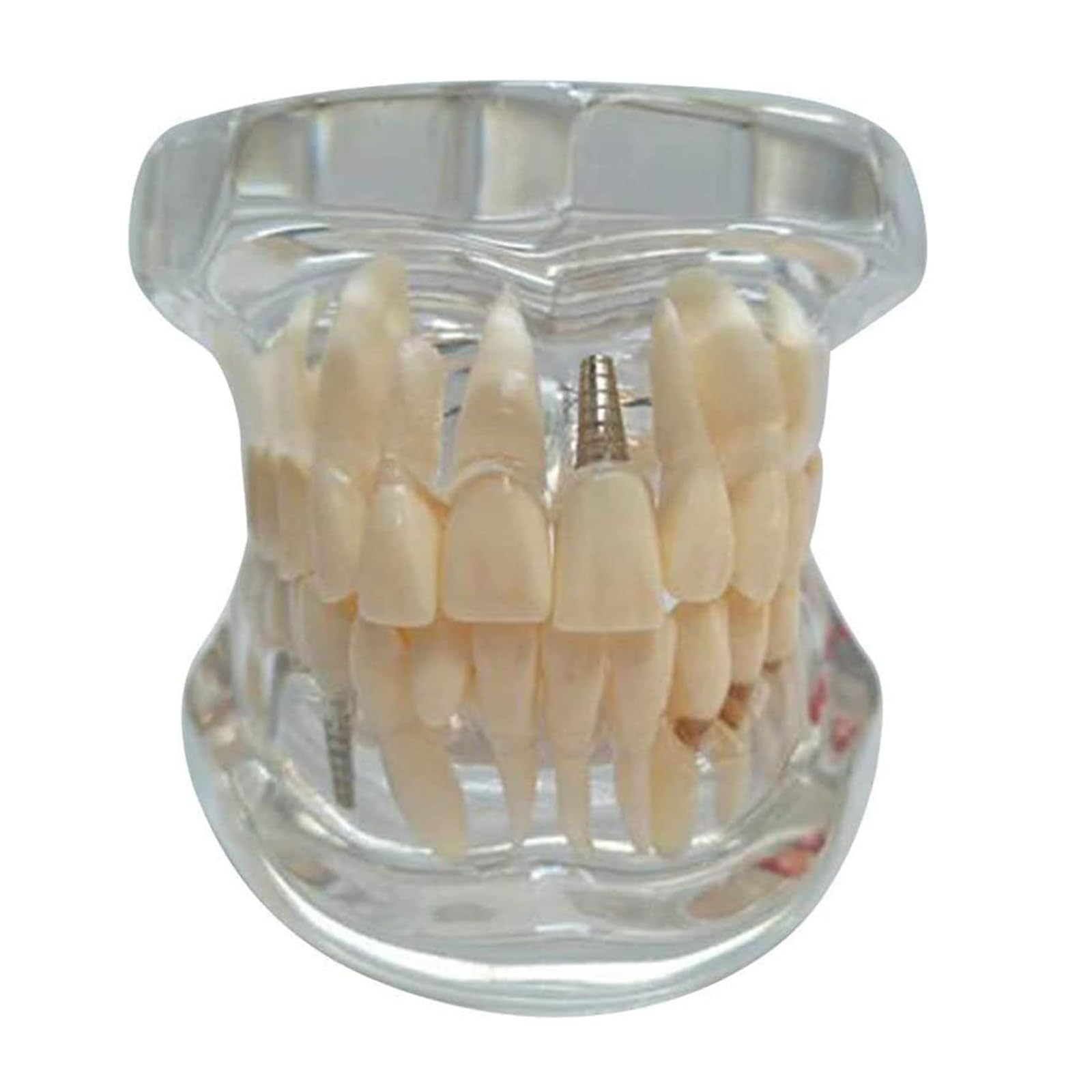 Modèle D'enseignement des Dents Humaines Pathologiques, Modèle De Dents De Démonstration pour Adultes, Modèle De Dents Transparentes Dentaires, Ouvert Et Fermé À 270° De Manière Flexible