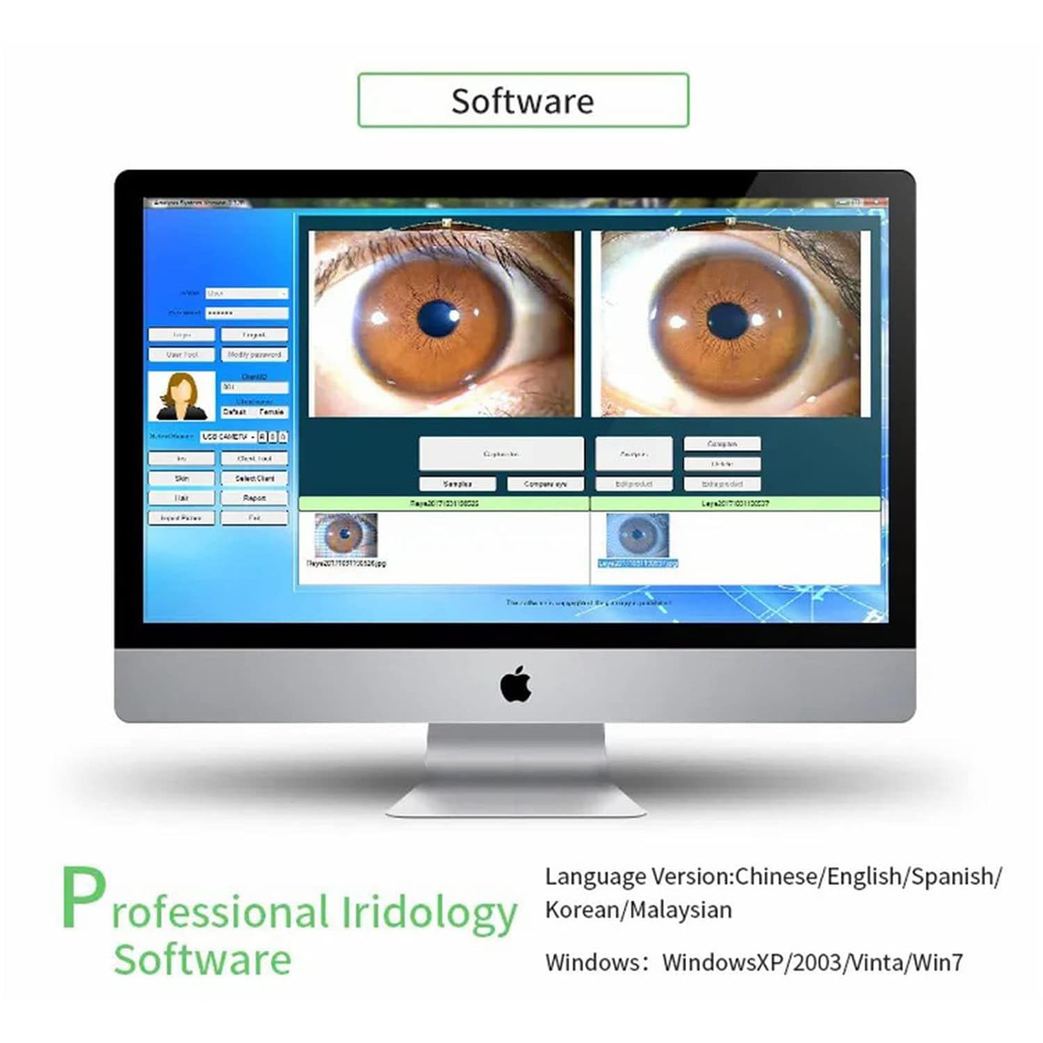 Kamera analizy Iris, przenośna kamera HD 12 m USB2.0, komputerowy wykrywacz tęczówki, analizator tęczówki z obiektywem Iris 30X HD i sterownikiem, bezpłatne oprogramowanie do analizy