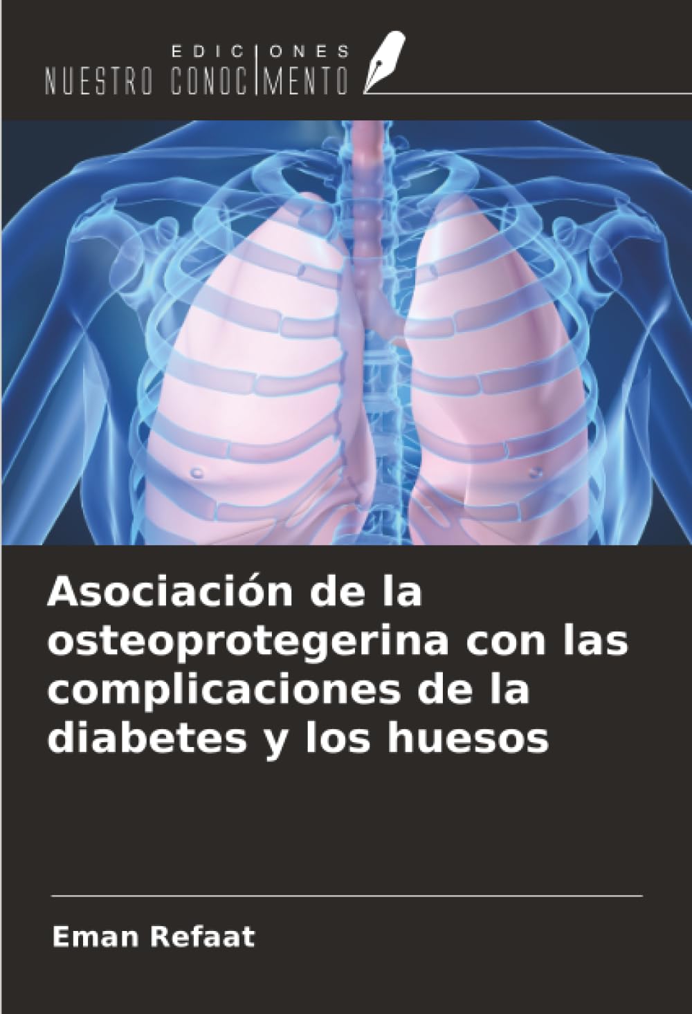 Asociación de la osteoprotegerina con las complicaciones de la diabetes y los huesos