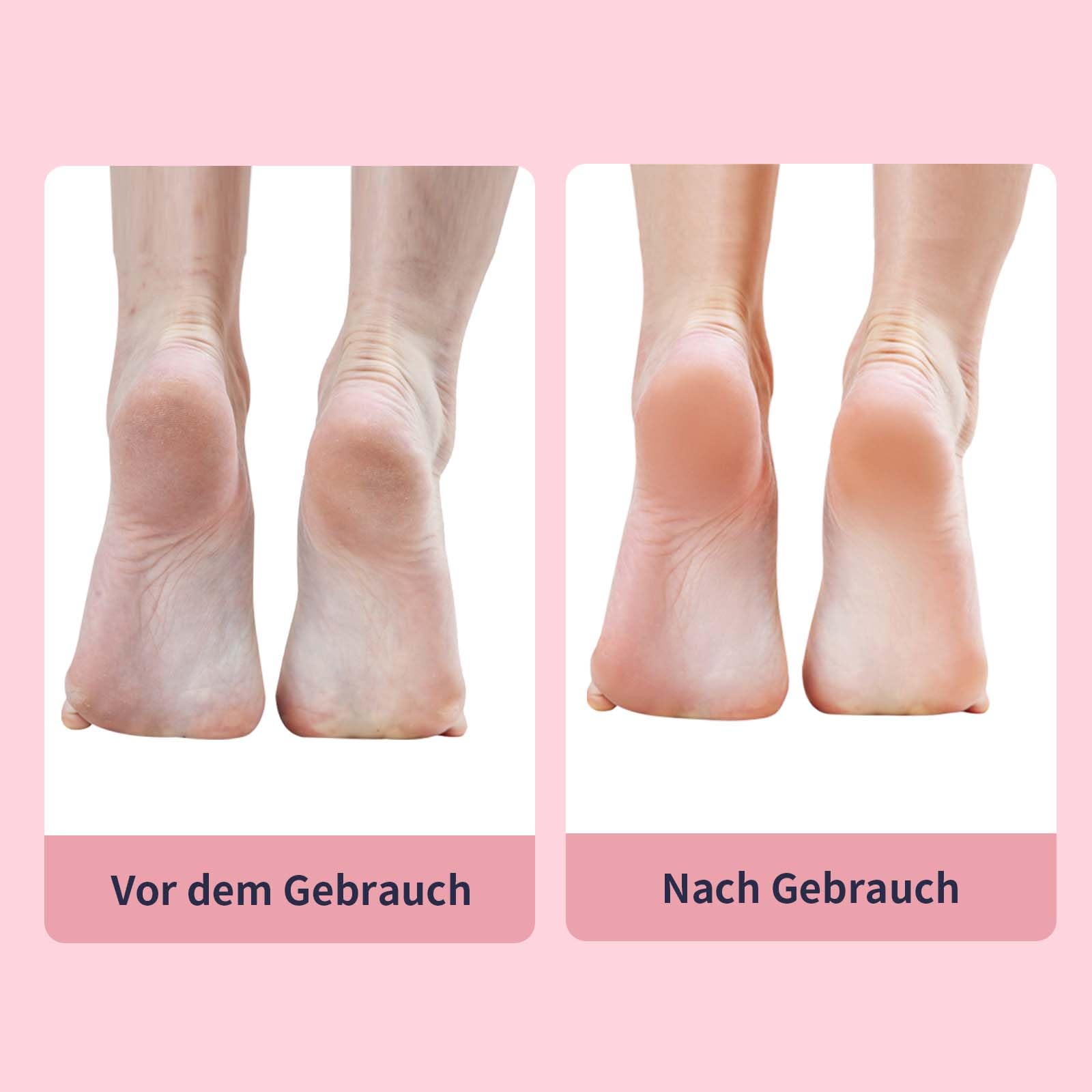AprElm-12.2CM Längerer Elektrischer Hornhautentferner für Füße mit 120 Schleifpapier, aus Aluminium, stufenlose Drehzahlregelung – Professionelles Pediküre Gerät für