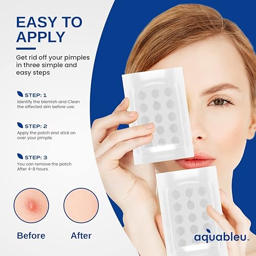 Miniatura 6 de AQUABLEU Parche de espinilla para el acné 40 parches hidrocoloides en 3 tamaños 0472 x 0394in  0630 x 0472in  0394 x 0551in  Para granos e