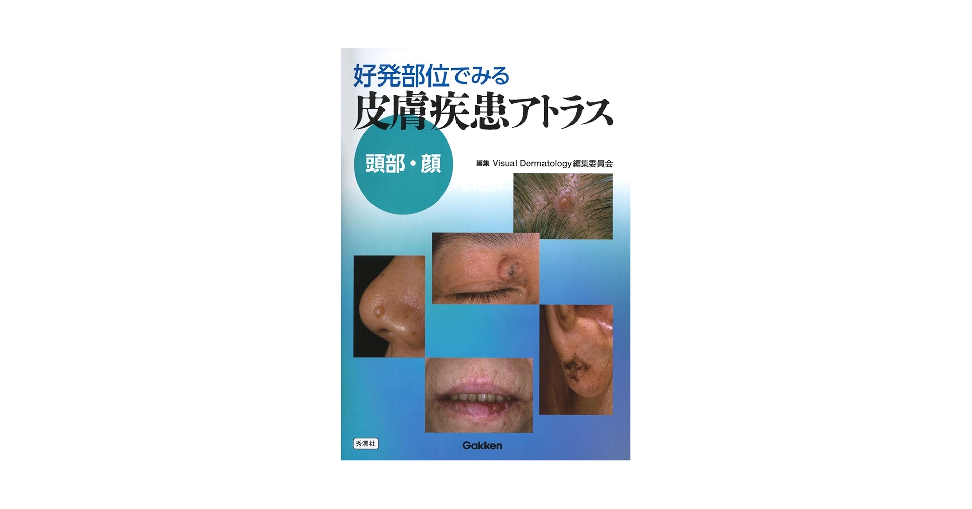 好発部位でみる皮膚疾患アトラス　躯幹・四肢/Ｇａｋｋｅｎ/Ｖｉｓｕａｌ　Ｄｅｒｍａｔｏｌｏｇｙ編集（単行本） Amazon.co.jp: 好発部位でみる皮膚疾患アトラス 頭部・顔: 頭