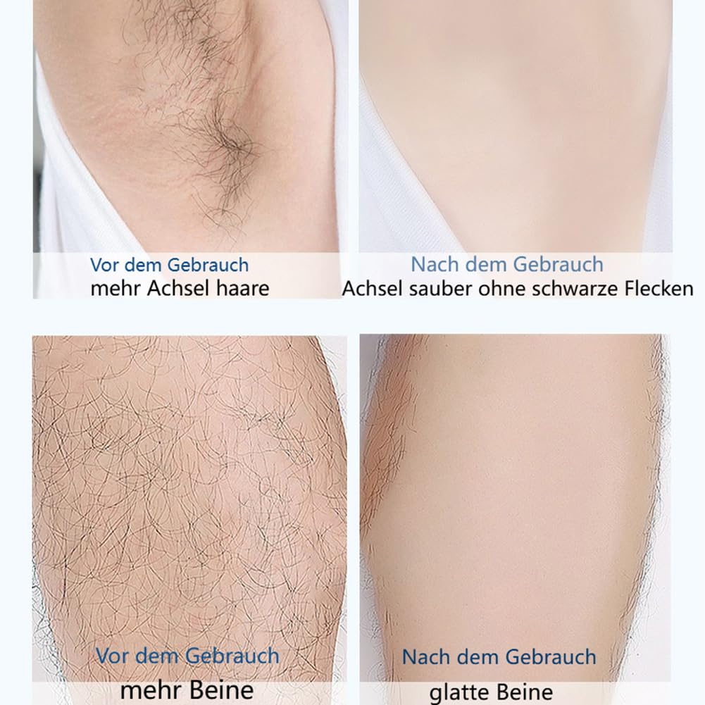 Rasierer Damen, 5-in-1 Damen-Intimtrimmer, Intimrasierer fur Frauen, Wasserdichter Damenrasierer Elektrisch für KöRper, Achseln, Bikini, Augenbrauen und Nase