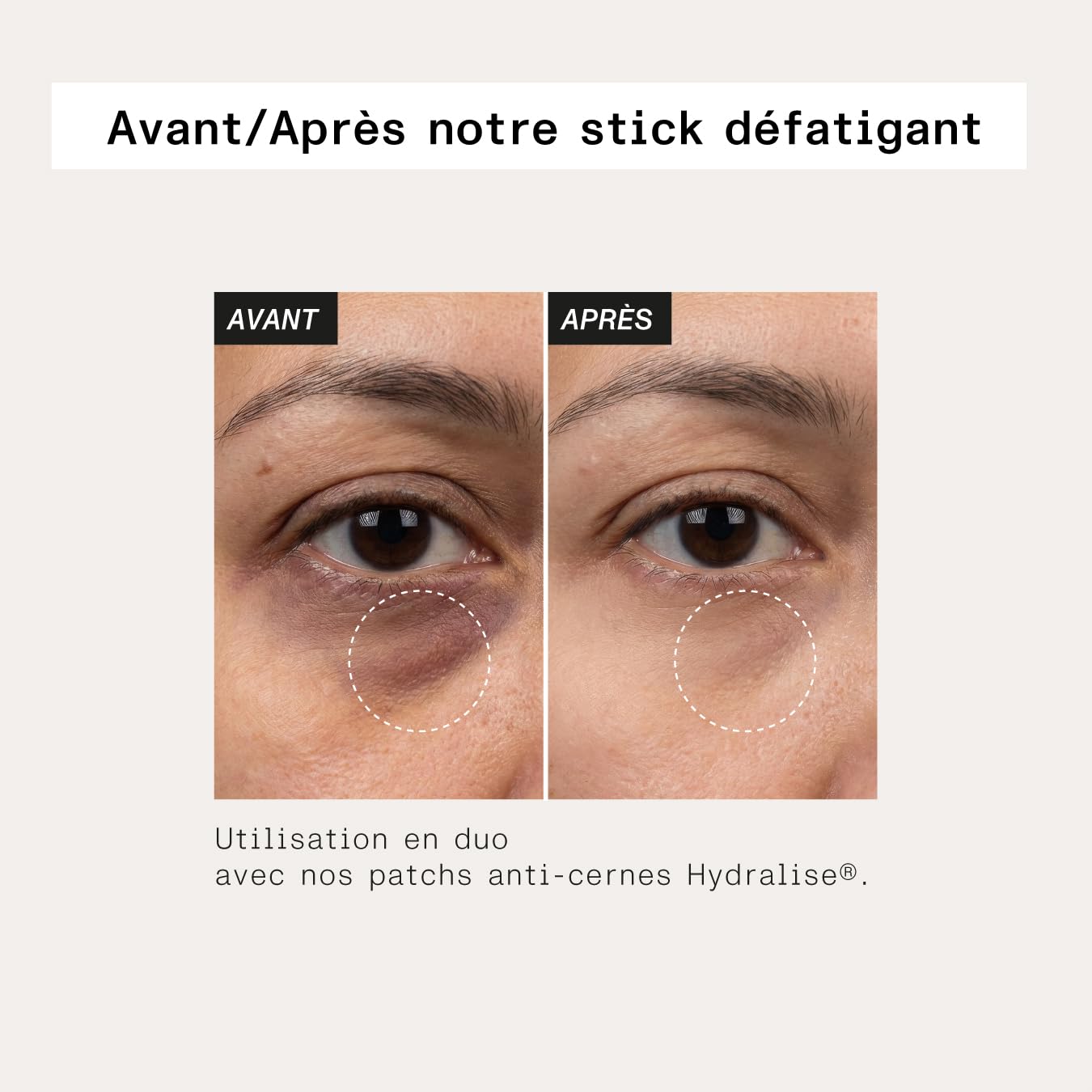 Stick Défatigant Aloe Paris 15 ml – Roll‑on regard défatigant à l’Aloe Vera Bio, Miel d’Acacia et Huile de Jojoba – Atténue poches, cernes, ridules & fatigue – Made in France, 98,9 % origine naturelle