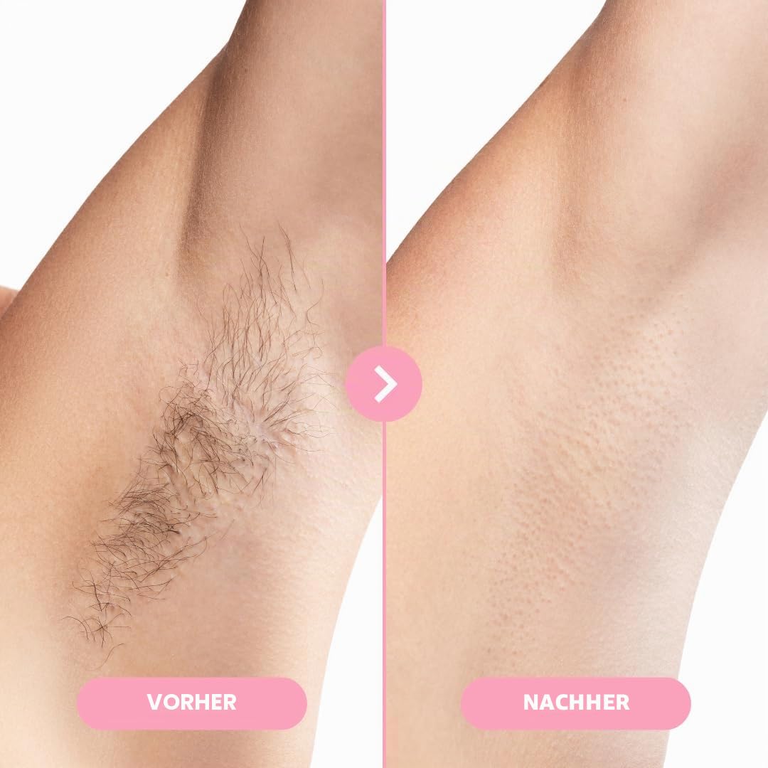osmo epiluxe epilierer 5 - in - 1 Kabelloser Epilierer für Damen, Wet & Dry, Langanhaltende Haarentfernung, Weißer Epiliergerät für Gesicht und Körper