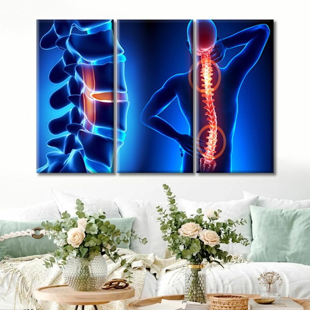 Human Spine Musculatures and Pictures Wall Art 3 Panels Canvas Wall Art Medical Health Care Concept Painting Wall Decor Living Room Modern Home Decor Framed Ready to Hang 36" Wx24 H