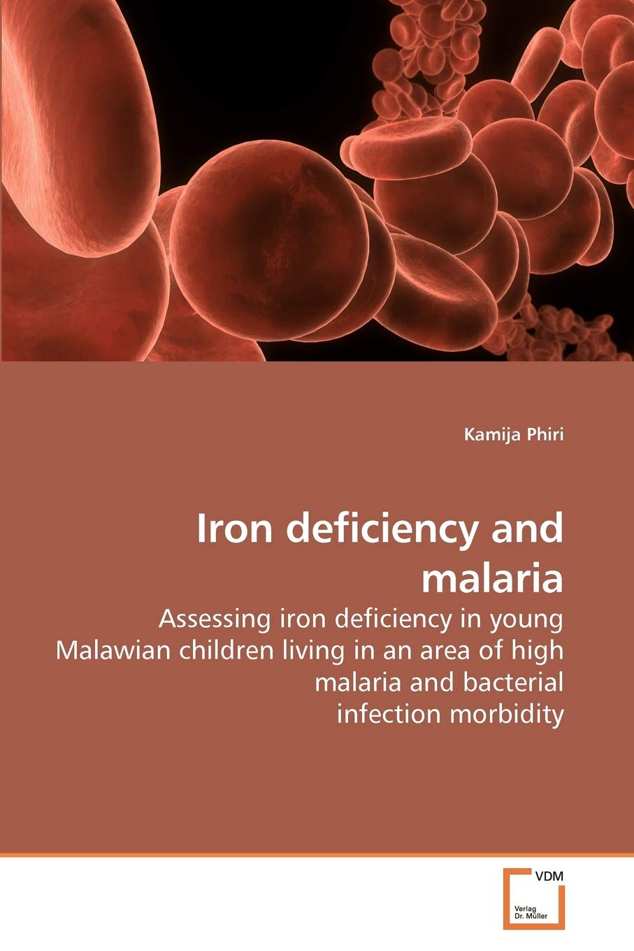 Buy Iron deficiency and malaria Assessing iron deficiency in young