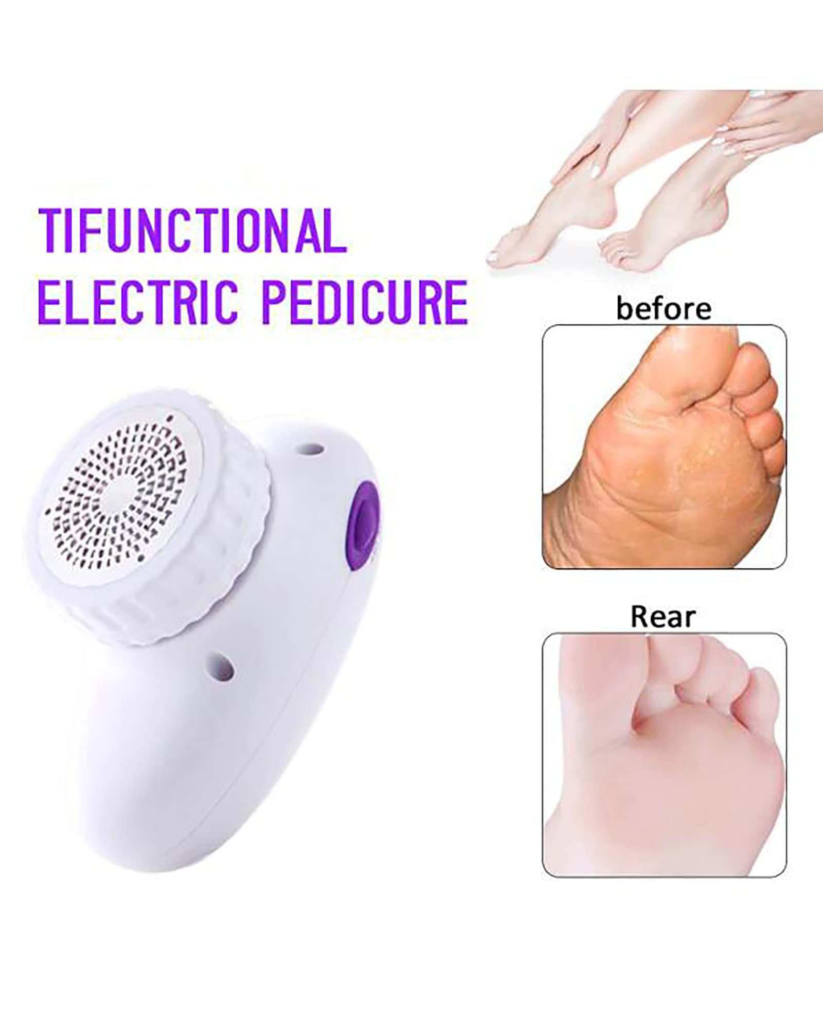 Lima eléctrica multifunción para pies y removedor de Callos, Amoladora de pies, Herramientas Profesionales de pedicura para Piel Seca Muerta/Agrietada