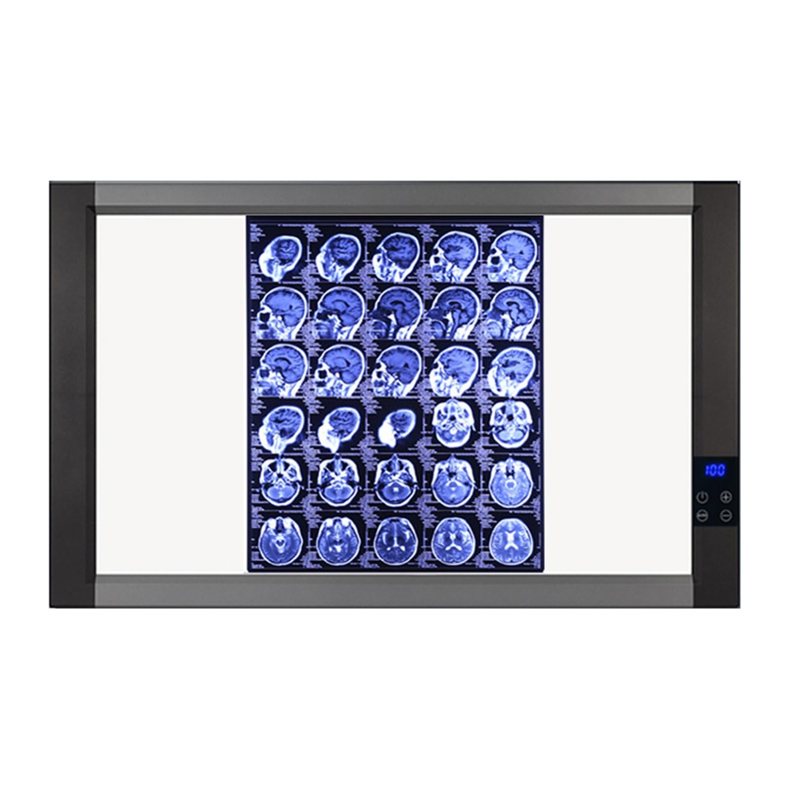 Amazon.com: GMBAYUE X-ray Film Illuminator Light Box, X-Ray LED