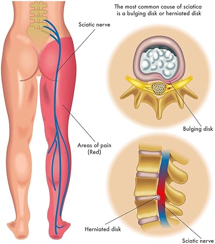 Miniatura 3 de 2 TUBO Flekosteel bálsamo corporal de calentamiento 2 x (1,7 oz 1.7 fl oz). Original de Rusia con holograma. Stock fresco