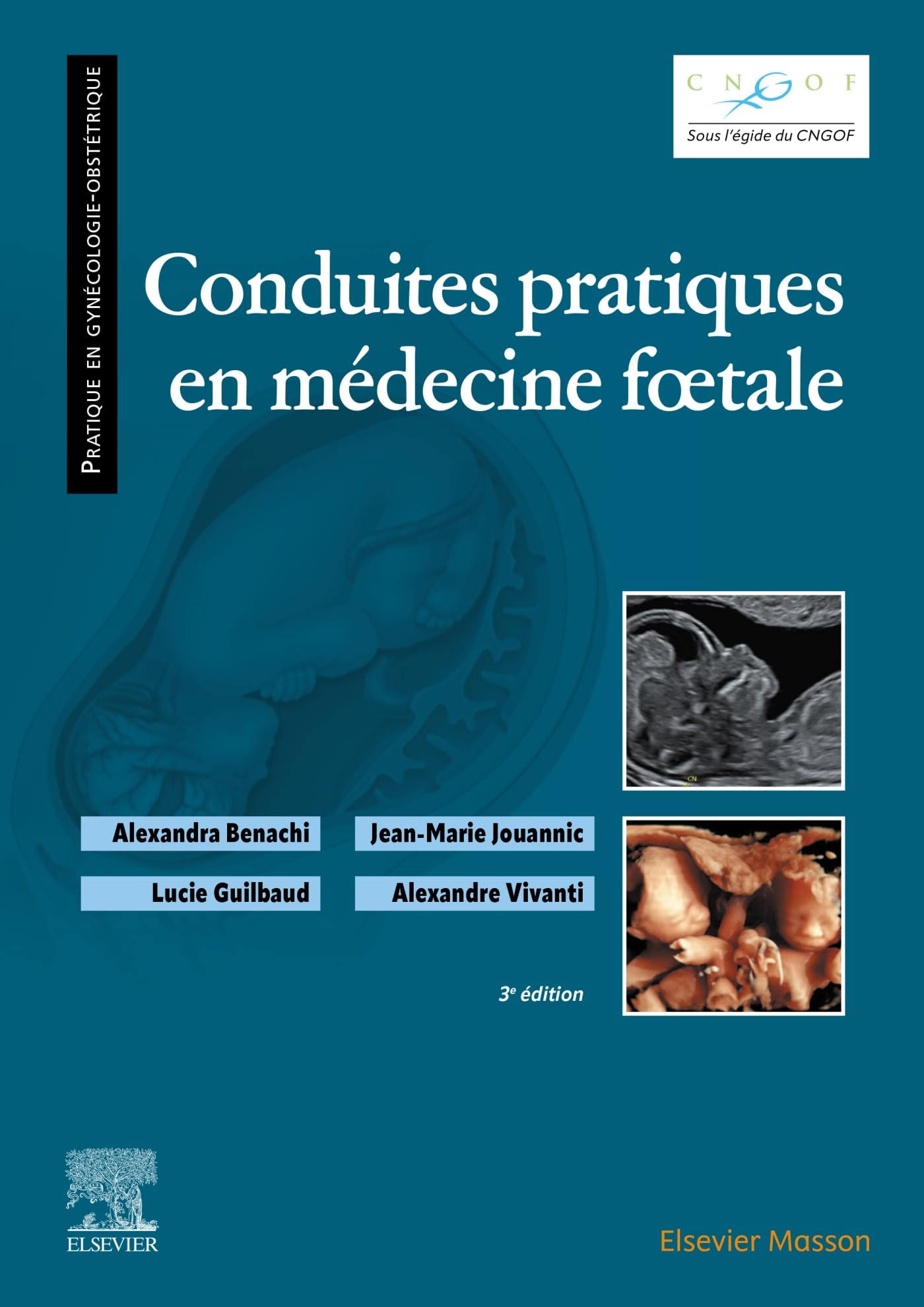 Elsevier Masson Conduites Pratiques En Médecine Foetale