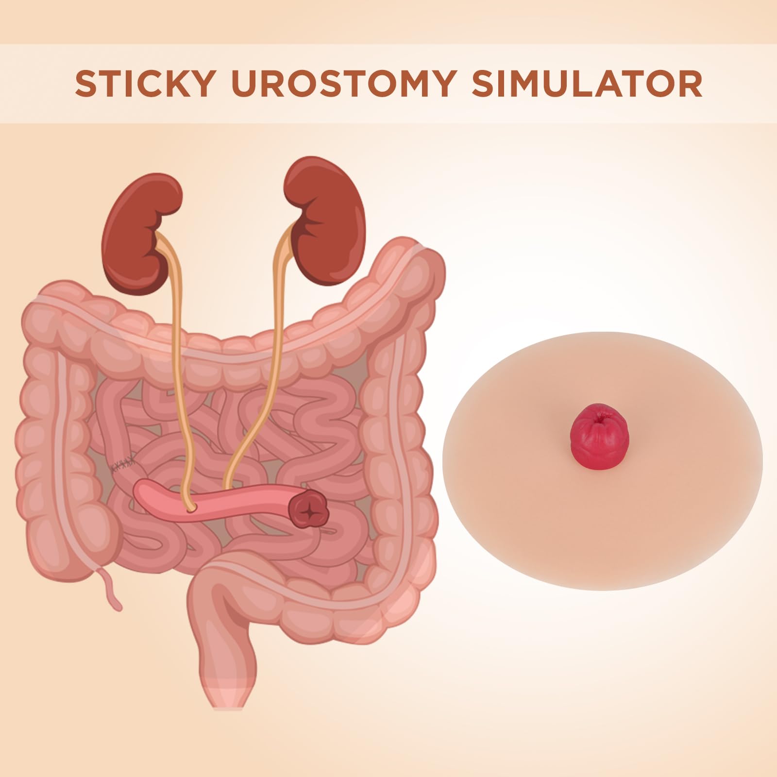 MedEduQuest Sticky Urostomy Simulator, Stoma Training Model Set