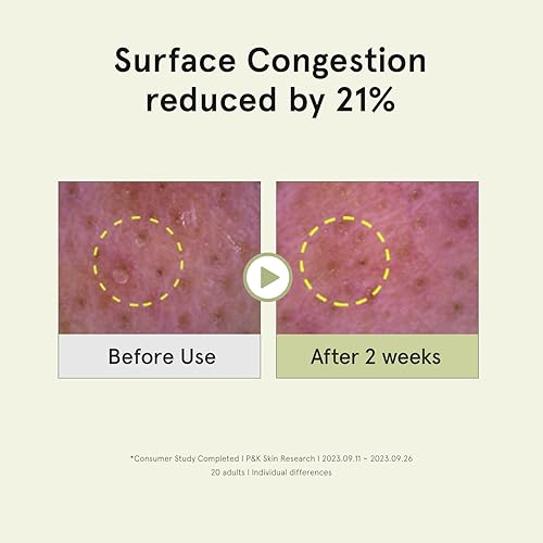 Miniatura 5 de ONE THING CICA - Almohadilla de tóner para pelar 6.34 onzas, 65 almohadillas | Almohadillas de tóner de algodón facial veganas calmantes,