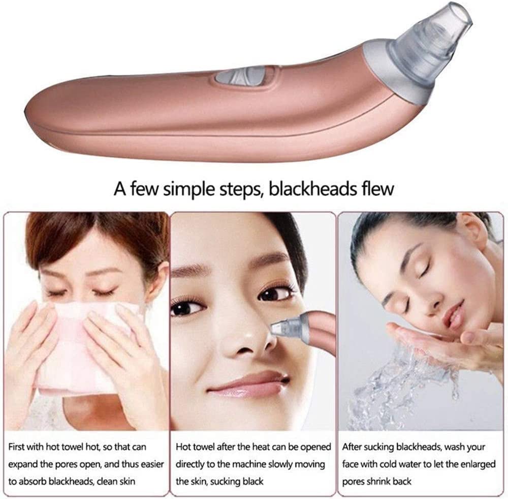 ESHINEDE Aspirapolvere for punti neri Aspirapolvere for punti neri Estrattore di comedoni for acne Strumento di aspirazione for punti neri ricaricabile USB con 4 sonde for la rimozione dell'acne di pu