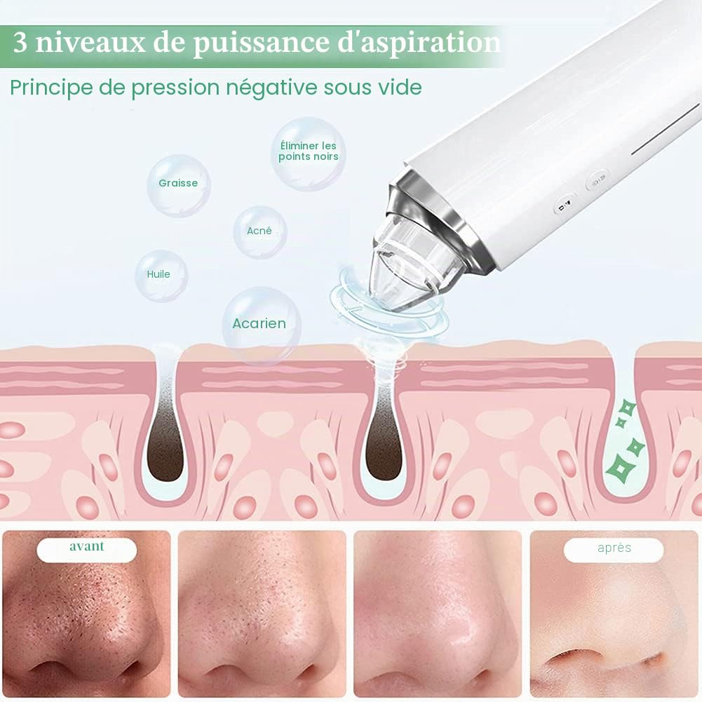 Aspirateur Point Noir, prabensei Nettoyant Pour Pores Du Visage Visible WIFI Amélioré Avec Caméra à Boutons Avec 6 Têtes d'aspiration Outil d'aspiration électrique Rechargeable