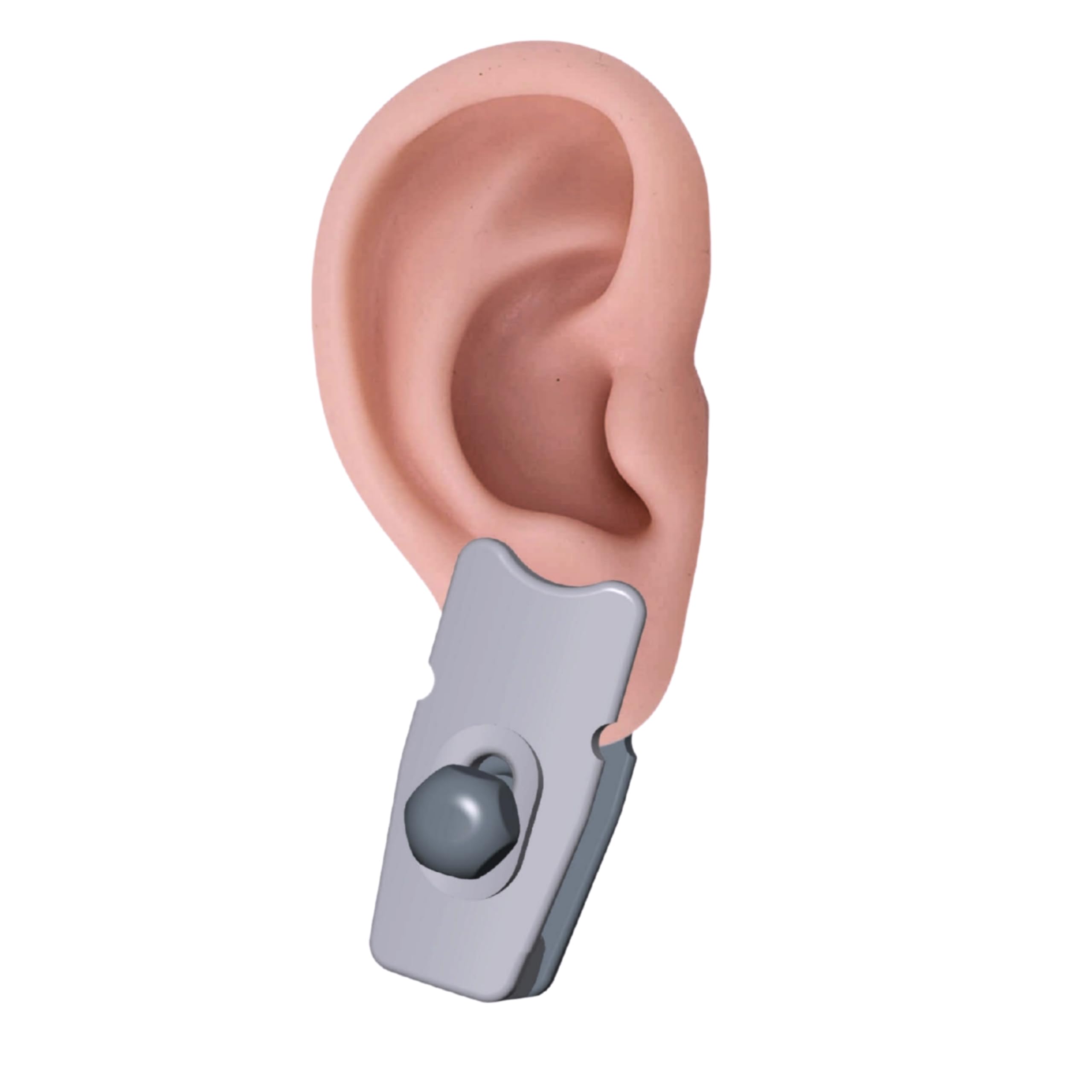 Ear Keloid Compression Clip Adjustable Earrings for Keloids, Post-Surgery Scar Treatment and Scar Prevention Adjustable Pressure Control Medical Grade Material | Pack of (1)-image-45