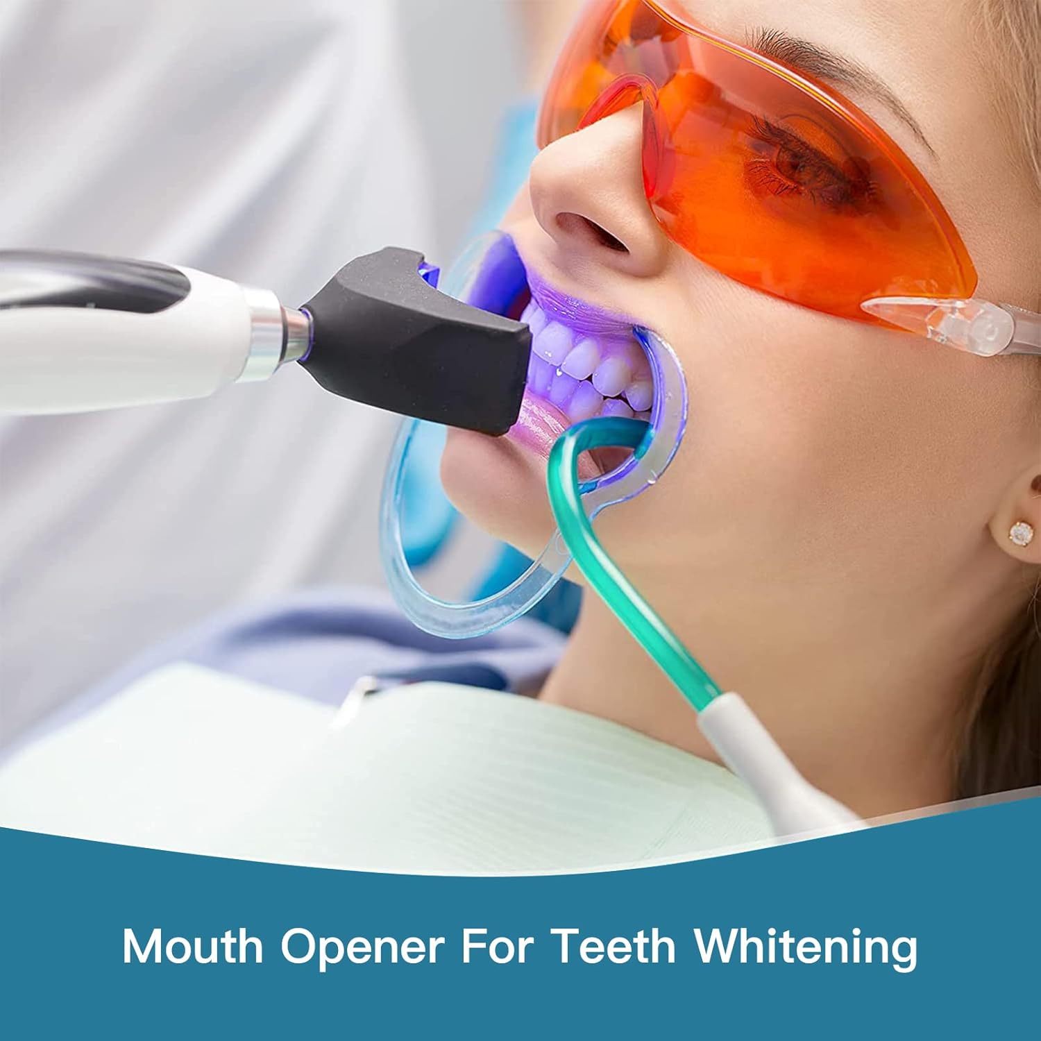 Person using an AZDENT cheek retractor during a teeth whitening procedure