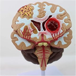Medical Human Brain Anatomical Model - Human Brain Disease Model - Brain Pathologies Brainstem Cerebral Study Anatomy Model - for Medical Traning for Medical Demonstration