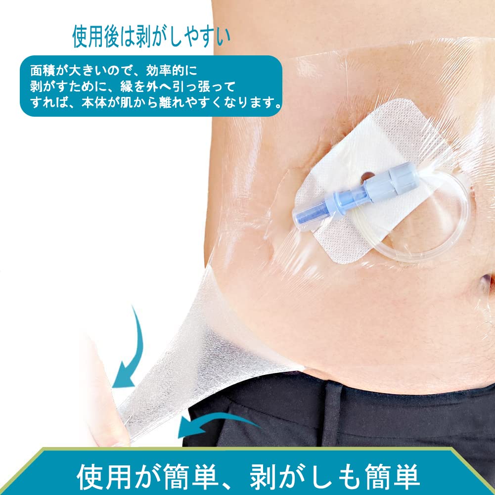 バラ売り可＞人工透析等 カテーテル保護資材等 DWを正しく評価するため