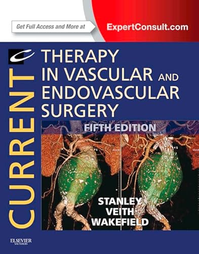 Current Therapy in Vascular and Endovascular Surgery (CURRENT THERAPY IN VASCULAR SURGERY)
