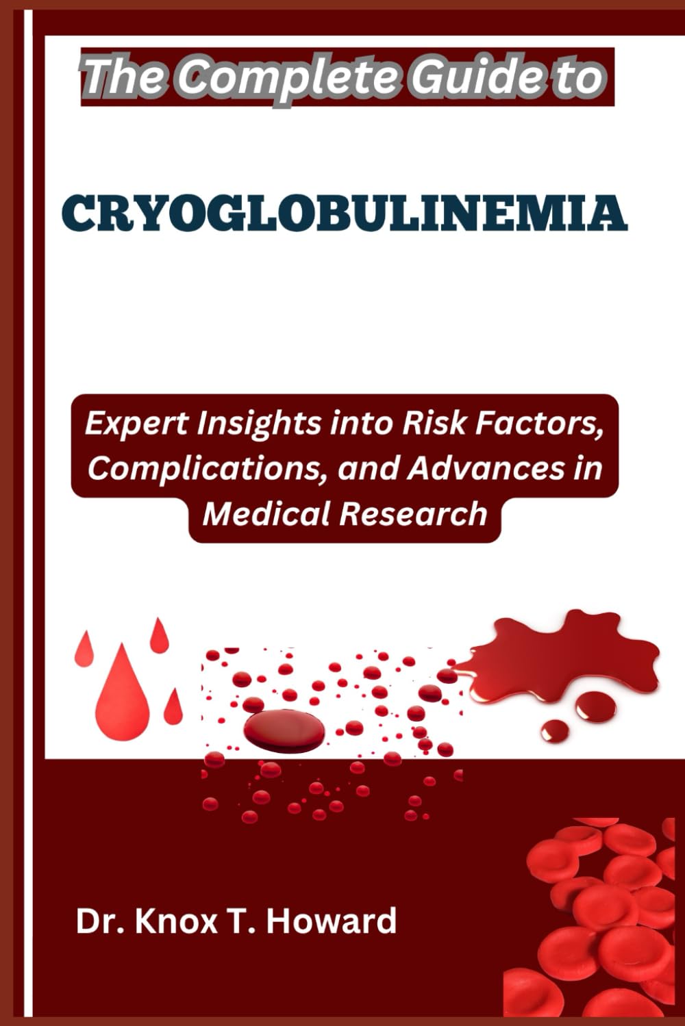 The Complete Guide to Cryoglobulinemia: Expert Insights into Risk Factors, Complications, and Advances in Medical Research