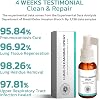 Lung Cleansing Spray - Herbal Lung Cleansing Spray,Herbal Lung Cleanse Mist,Herbal Spray Cleansing Lung,Powerful Lung Support & Cleanse,Relieve Body Discomfort Fatigue Relax Body (2 Pcs)
