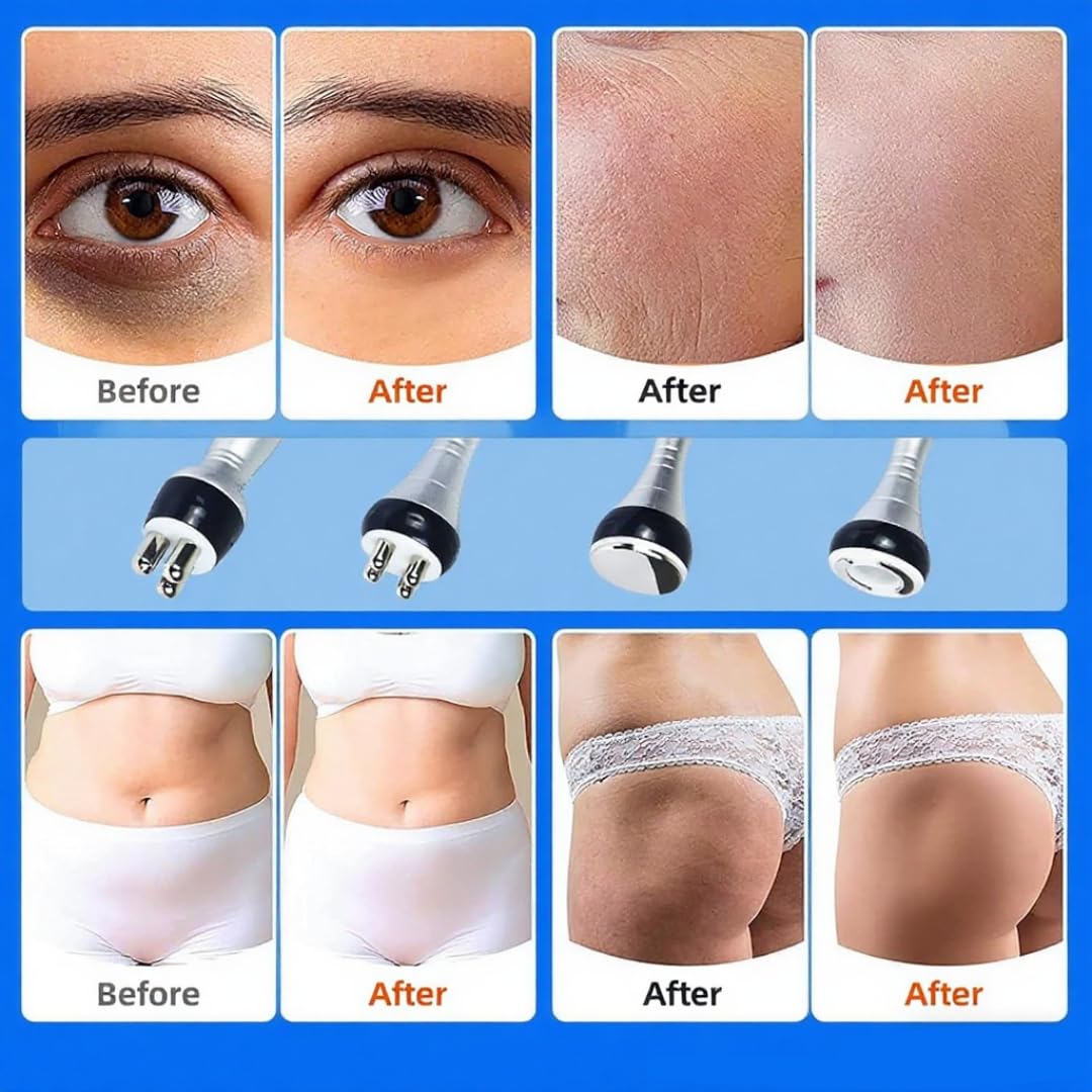 Radiofrecuencia Facial Corporal Reafirmante Dispositivo profesional de facial, máquina de de 40 kHz para reafirmar la piel del rostro y los ojos, antiarrugas y lifting, herramienta de bellez