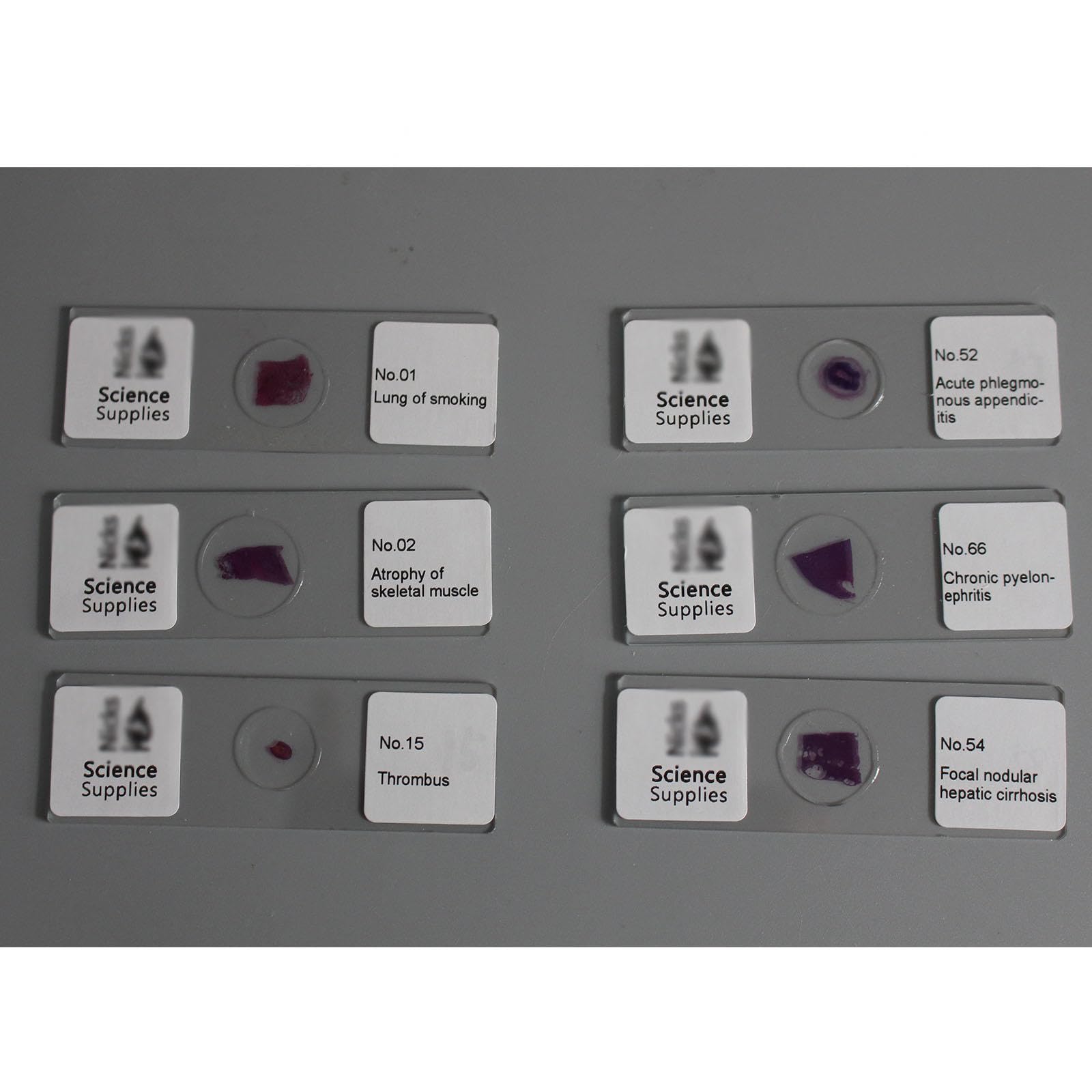 100 Piezas de Muestra de Sección Patológica Humana, Portaobjetos de Observación de Microscopio, Rebanadas Claramente Estructuradas, Material de Vidrio para Enseñanza de Educación de Estudios