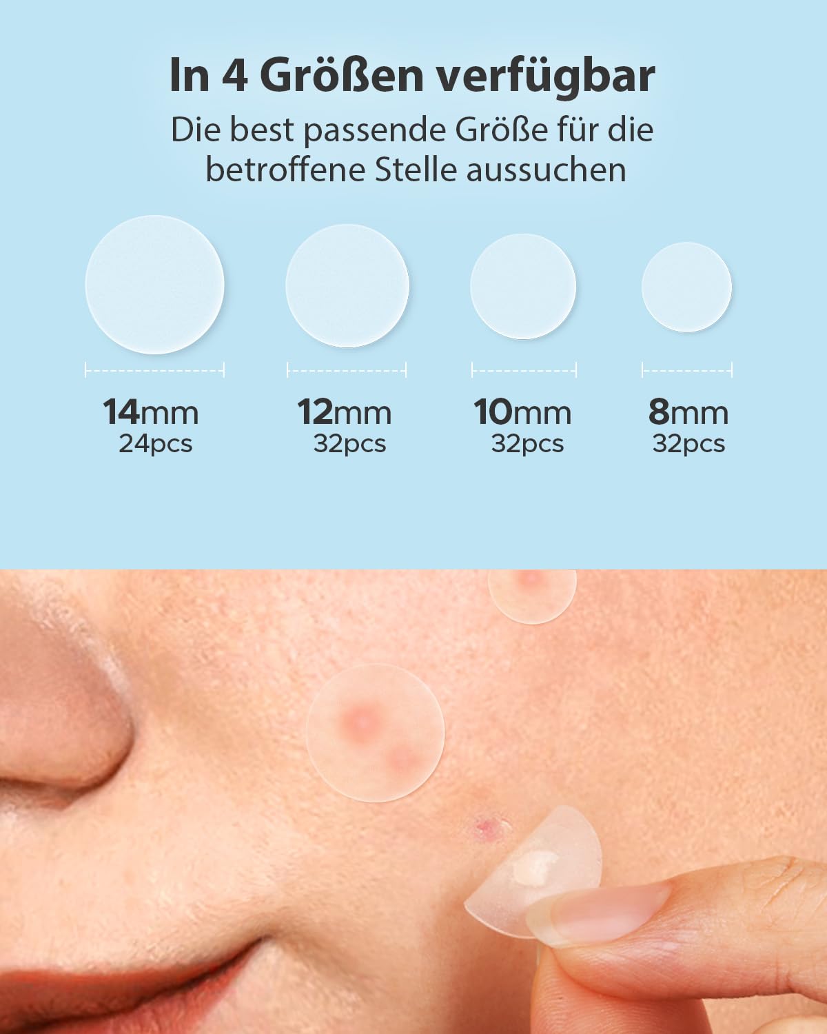 LitBear Parches de pimple, 4 tamaños para día y noche, 180 parches hidrocoloides finos y gruesos con hamamelis, aceite de árbol de té y aceite de caléndula, parches para el acné extra adherentes para