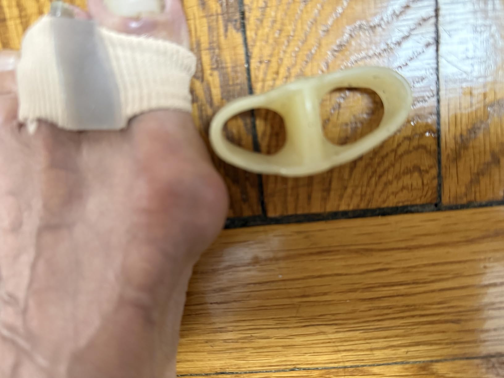 comparing 2 different types of toe spacers ...