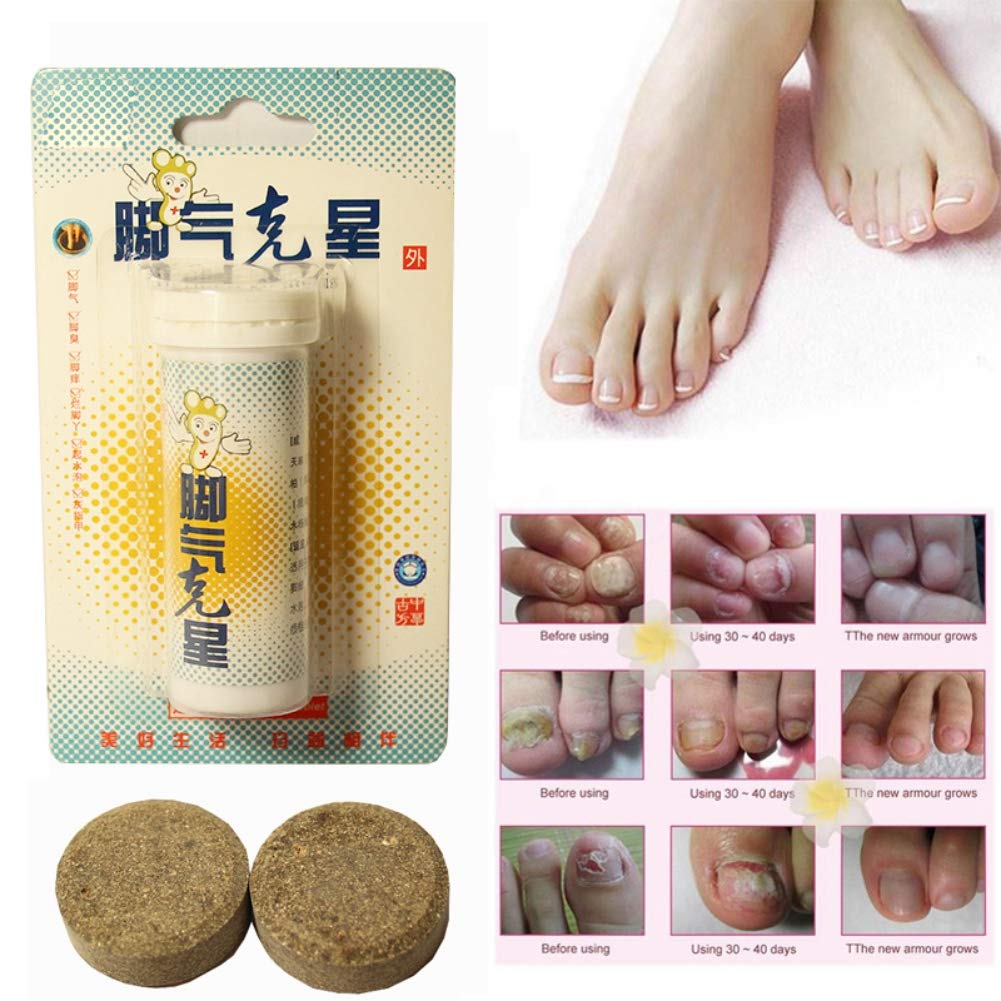Chagoo Anti-fungal Peeling Fußbad-Tabletten – Mit Ingwer, Gegen Fußpilz & Für Entspannte Füße