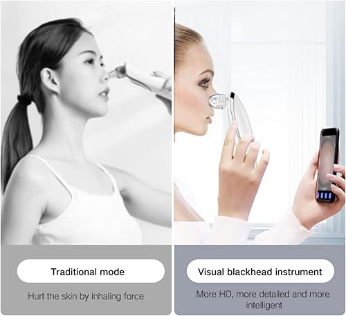 Miniatura 6 de NURINA Aspiradora de poros para eliminar puntos negros con cámara de 20 MP recargable por USB, aplicación de succión de poros visible y dispositivo