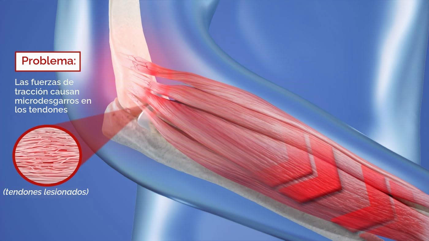 Masalo® Manguito MED – para codo de tenista, codo de golfista, brazo de ratón (epicondilitis) (talla 2/brazo derecho)