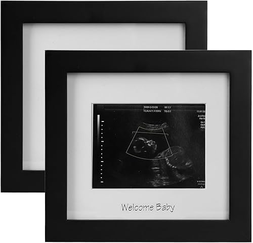 Miniatura 7 de IHEIPYE Marco de fotos de ecografía para bebé, marco de fotos de ultrasonido para futuros padres, baby showers, fiestas de revelación de género