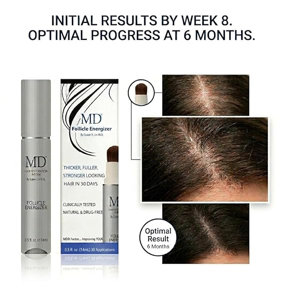 MD Follicle Energizer | Natural Hair Growth Serum | Biotin Infused to Block DHT Production and Prevents Hair Loss | 1 Fl Oz 60-Days Supply
