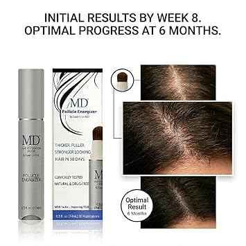 MD Follicle Energizer | Natural Hair Growth Serum | Biotin Infused to Block DHT Production and Prevents Hair Loss | 1 Fl Oz 60-Days Supply
