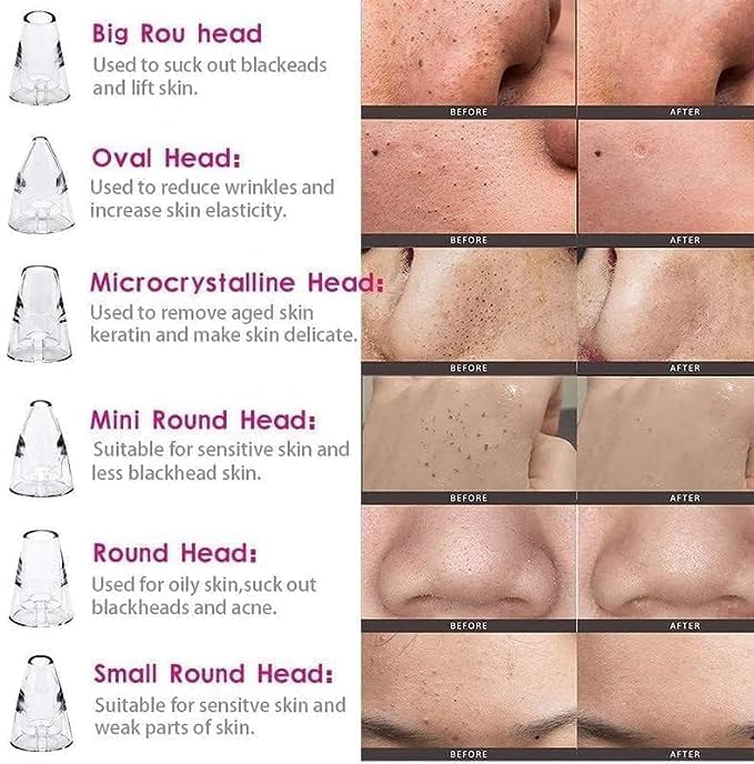 Image of 6 in 1 Multi-function Blackhead Remover Tools | Electric Derma suction Machine | USB Rechargeable Acne Pimple Pore Cleaner Vacuum tool - Facial Cleanser Device for Nose & Skin Care