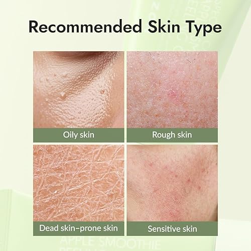 Miniatura 7 de Gel de peeling y exfoliación facial Mizon