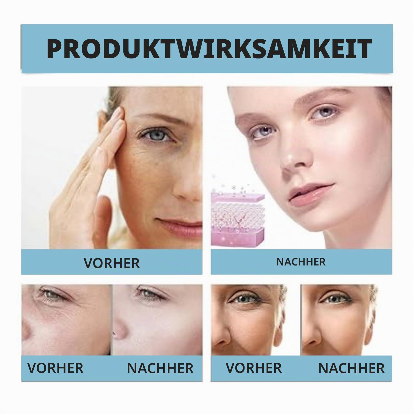 Micro Infusions System, Micro Infusion System Original, Mikroinfusionssystem Gesicht, Mc Micro Infusion System, Anti-Aging & Smooth Wrinkles Facial Serum (4 Mikronadeln + 12 Flaschen)