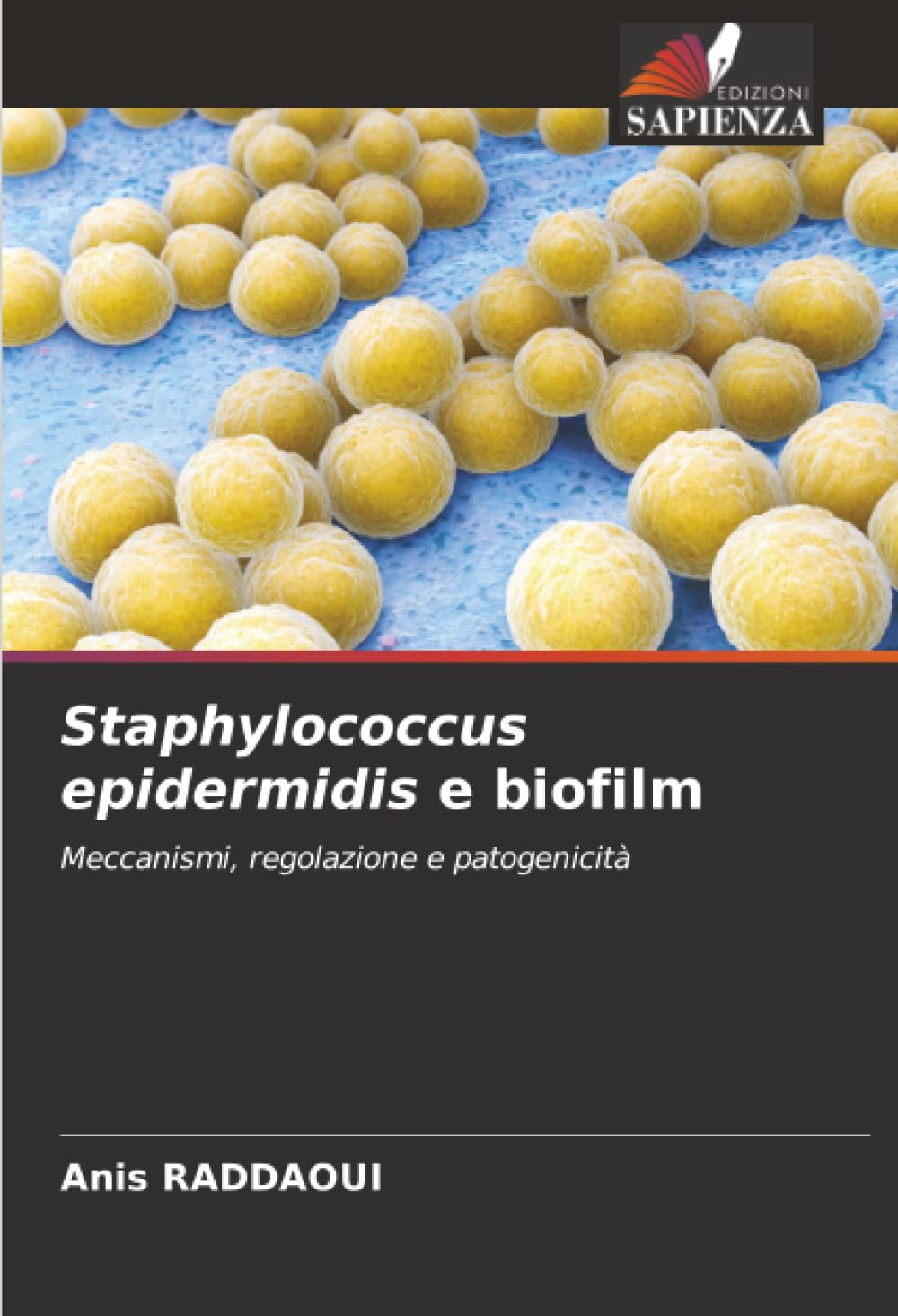 Staphylococcus epidermidis e biofilm: Meccanismi, regolazione e patogenicità