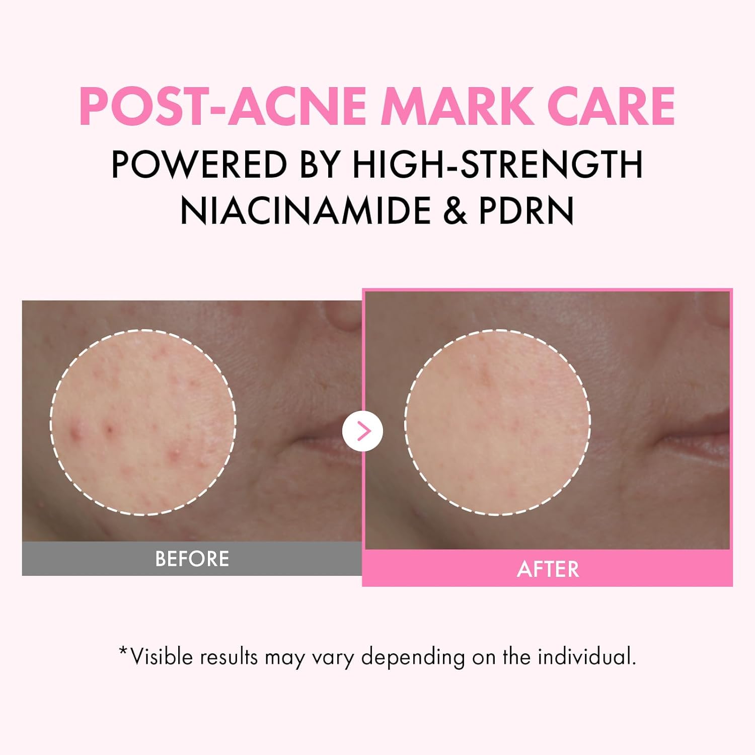 TOSOWOONG Pink PDRN Niacinamide Milky Toner, Niacinamide 5% Dark Spot Care, Salmon DNA PDRN Soothing, 3 Ceramides & 12 Peptides Moisturizing, Glass Glow Skin, Korean Skincare, 150ml / 5.07 fl. oz. - Image 2