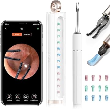 MEKK Smart Ear Wax Removal Kit S5-10MP HD Visual Ear Cleaner with Precision Tweezers, 12 Tools & Travel Case - Wireless Otoscope for iOS/Android White-S5