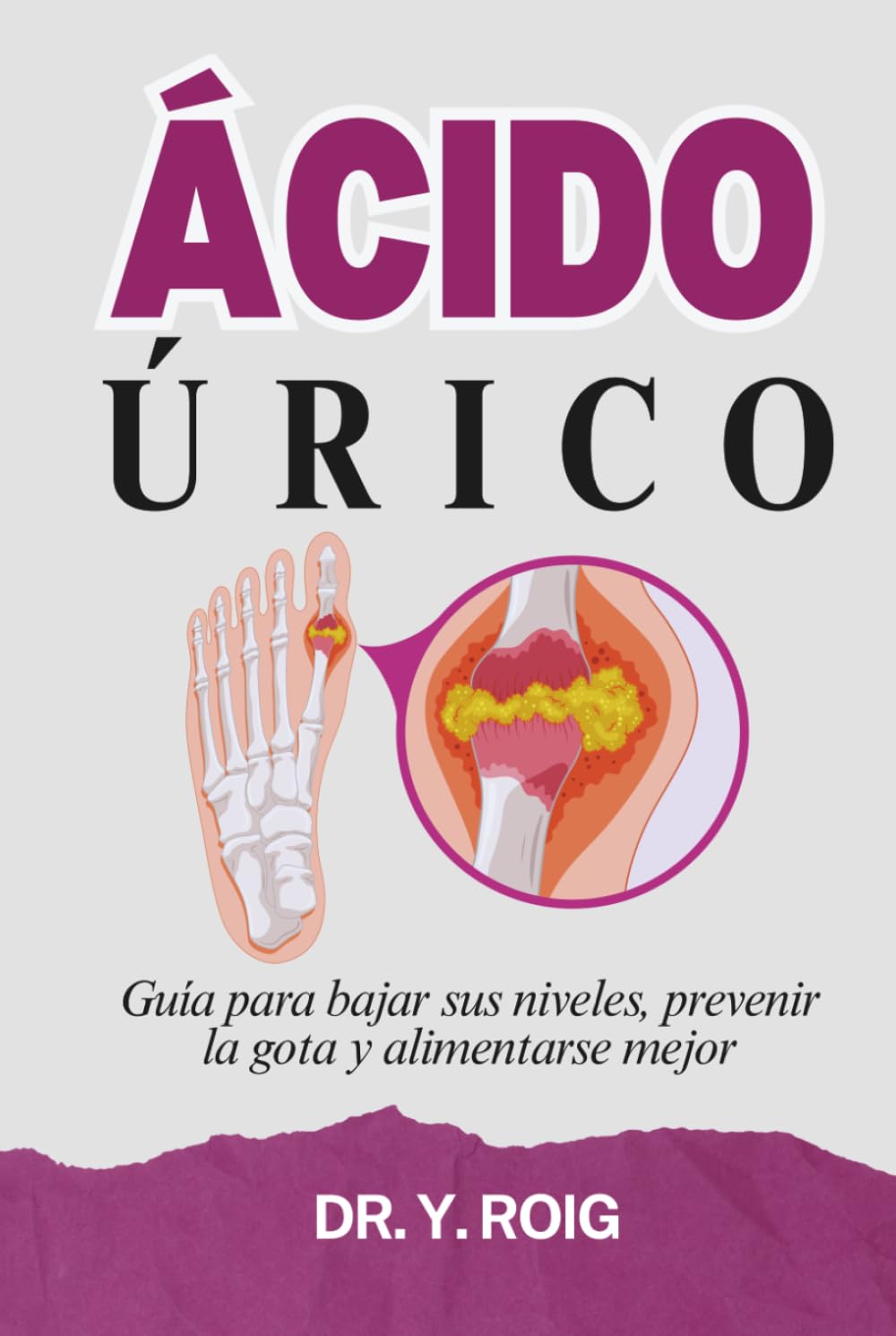 Ácido Úrico: Guía para bajar sus niveles, prevenir la gota y alimentarse mejor