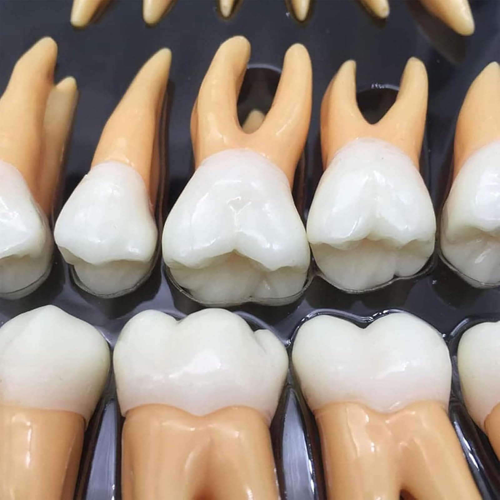 Kit di denti dentali ingranditi con custodia, strumento didattico educativo per professionisti dentali e studenti