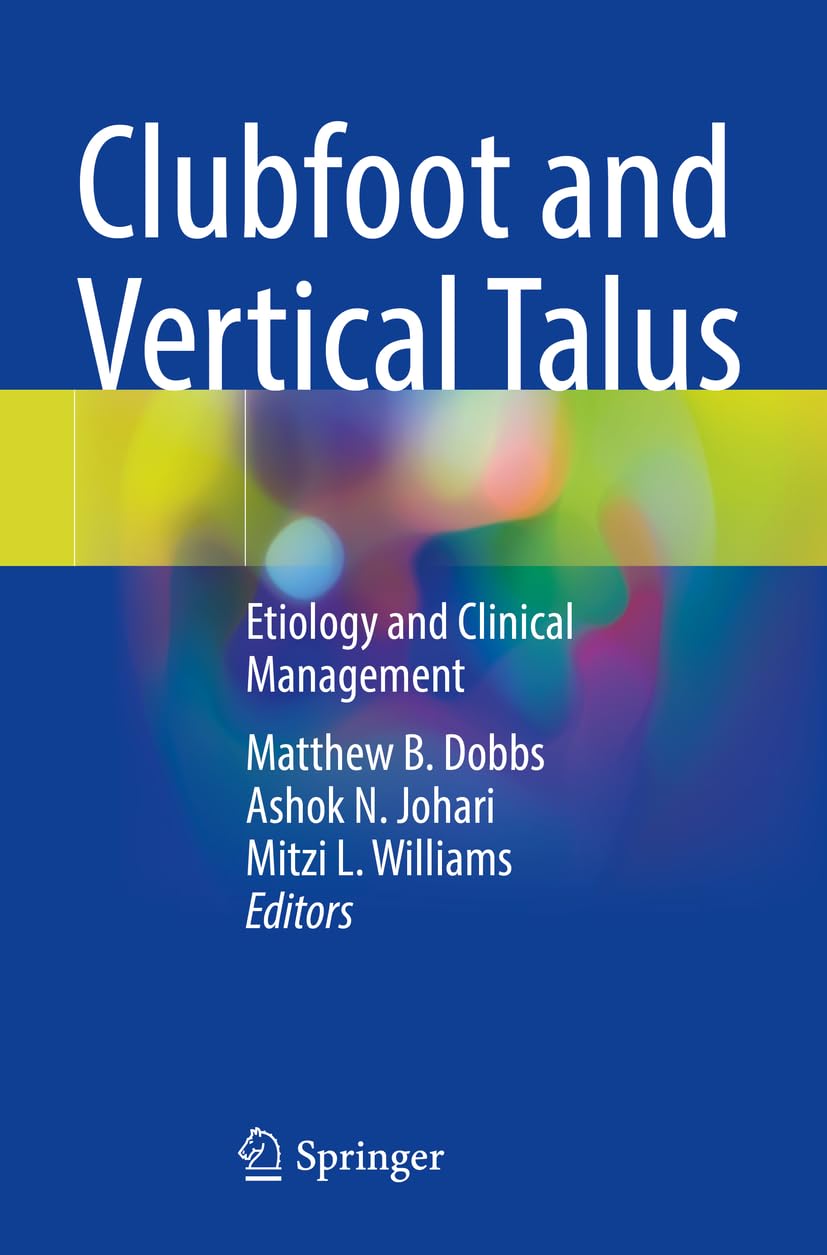 Clubfoot and Vertical Talus - 9783031358852