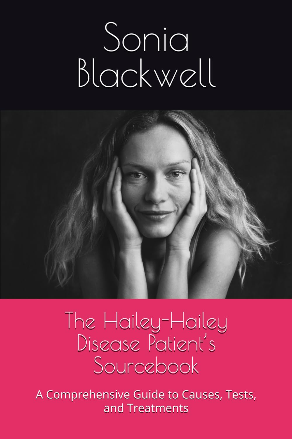 The Hailey-Hailey Disease Patient’s Sourcebook: A Comprehensive Guide to Causes, Tests, and Treatments
