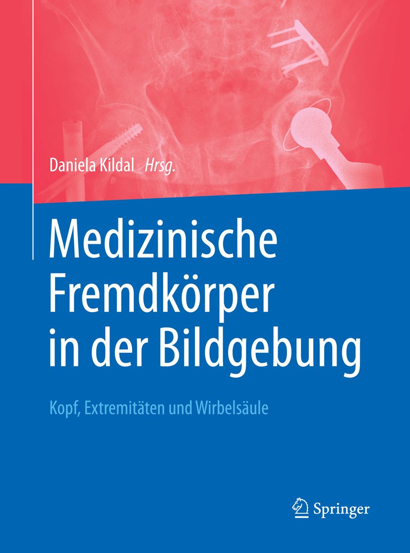 Medizinische Fremdkörper in der Bildgebung: Kopf, Extremitäten und Wirbelsäule